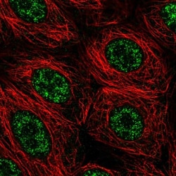 FIBP Antibody, Novus Biologicals 25 &mu;L; Unlabeled:Antibodies, Polyclonal